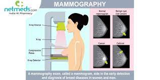 mamography
