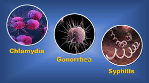 sexually transmitted diseases